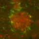 Image for article titled Commonly-Prescribed Drug Significantly Reduces Memory Loss from Alzheimers
